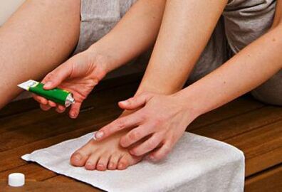 aplicarea de unguent pentru tratamentul ciupercii unghiilor de la picioare